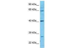Host:  Rabbit  Target Name:  PTOV1  Sample Type:  721_B Whole Cell lysates  Antibody Dilution:  0.