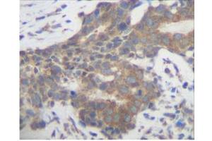 Image no. 2 for anti-Placenta Growth Factor (PGF) antibody (ABIN181639) (PLGF anticorps)