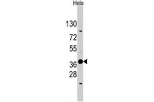 Western blot analysis of EDA polyclonal antibody  in HeLa cell lysate (35 ug/lane). (Ectodysplasin A anticorps  (N-Term))