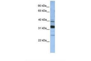 Image no. 1 for anti-Thioredoxin-Related Transmembrane Protein 4 (TMX4) (C-Term) antibody (ABIN6738588) (TMX4 anticorps  (C-Term))
