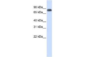 MST1 antibody used at 1 ug/ml to detect target protein.
