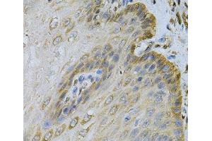 Immunohistochemistry of paraffin-embedded Human esophagus using PGK1 Polyclonal Antibody at dilution of 1:100 (40x lens).