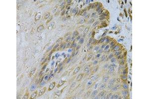 Immunohistochemistry of paraffin-embedded Human esophagus using PGK1 Polyclonal Antibody at dilution of 1:100 (40x lens). (PGK1 anticorps)