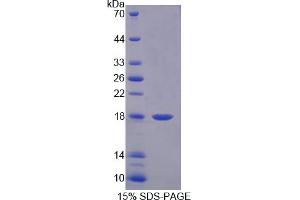 Image no. 1 for gamma-Interferon-Induced Monokine (CXCL9) (AA 22-125) protein (His tag) (ABIN6236803)