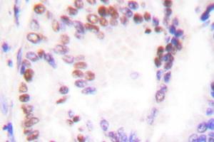 Image no. 1 for anti-Histone Deacetylase 9 (HDAC9) antibody (ABIN265461) (HDAC9 anticorps)
