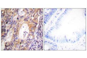 Immunohistochemistry (IHC) image for anti-Met Proto-Oncogene (MET) (pTyr1003) antibody (ABIN1847353) (c-MET anticorps  (pTyr1003))