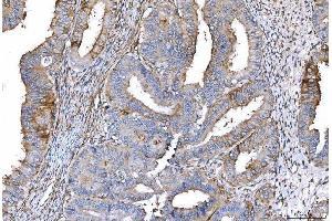 IHC analysis of CD55 using anti-CD55 antibody (ABIN7601422).