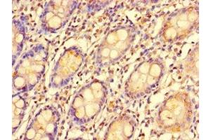 Immunohistochemistry of paraffin-embedded human colon tissue using ABIN7151974 at dilution of 1:100 (EDEM2 anticorps  (AA 22-300))