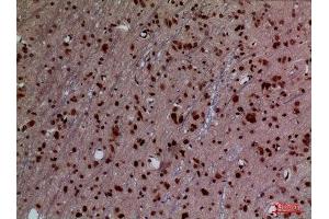 Immunohistochemistry (IHC) analysis of paraffin-embedded Rat Brain, antibody was diluted at 1:100.