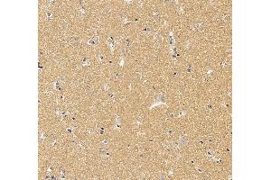 IHC analysis of WFS1 using anti-WFS1 antibody (ABIN7602165).