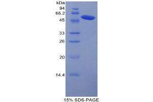 SDS-PAGE (SDS) image for Carboxypeptidase N Subunit 1 (CPN1) (AA 221-449) protein (His tag,GST tag) (ABIN1879787)