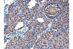 IHC-P Image KAP1 antibody [N1N2], N-term detects KAP1 protein at nucleus on mouse ovary by immunohistochemical analysis. (KAP1 anticorps  (N-Term))