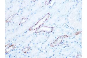 Immunohistochemistry of paraffin-embedded rat kidney using IR Rabbit mAb (ABIN7268009) at dilution of 1:100 (40x lens).