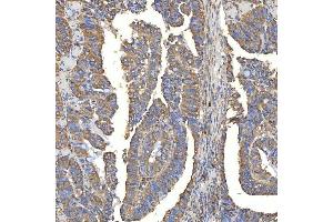 IHC analysis of TXNDC5 using anti-TXNDC5 antibody (ABIN7599699). (TXNDC5 anticorps  (AA 109-403))
