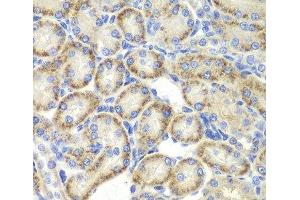 Immunohistochemistry of paraffin-embedded Rat kidney using ST3GAL4 Polyclonal Antibody at dilution of 1:200 (40x lens). (ST3GAL4 anticorps)