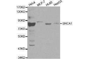 Western blot analysis of extracts of various cell lines, using BRCA1 antibody. (BRCA1 anticorps  (AA 120-220))