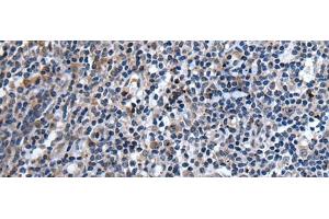 Immunohistochemistry of paraffin-embedded Human tonsil tissue using TNFSF18 Polyclonal Antibody at dilution of 1:45(x200) (TNFSF18 anticorps)