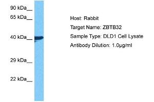 Host: Rabbit Target Name: ZBTB32 Sample Tissue: Human DLD1 Whole Cell Antibody Dilution: 1ug/ml (ZBTB32 anticorps  (N-Term))