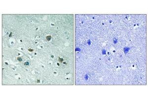 Immunohistochemical analysis of paraffin-embedded human brain tissue using CRMP-2 (Phospho-Thr509) antibody (left)or the same antibody preincubated with blocking peptide (right).