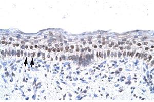 Human Spermatophore; ZNF500 antibody - middle region in Human Spermatophore cells using Immunohistochemistry (ZNF500 anticorps  (Middle Region))