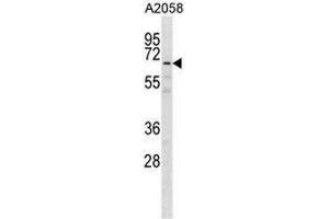 GPKOW Antibody (Center) western blot analysis in A2058 cell line lysates (35µg/lane). (GPKOW anticorps  (Middle Region))