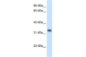 HMGCL antibody used at 1.