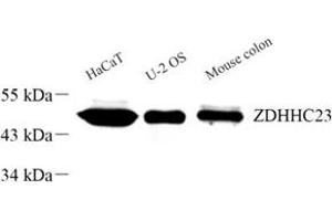 Western blot analysis of ZDHHC23 (ABIN7076281) at dilution of 1: 300
