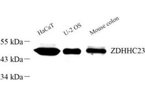 Western blot analysis of ZDHHC23 (ABIN7076281) at dilution of 1: 300 (ZDHHC23 anticorps)
