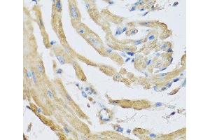 Immunohistochemistry of paraffin-embedded Mouse heart using SFRP4 Polyclonal Antibody at dilution of 1:100 (40x lens). (SFRP4 anticorps)