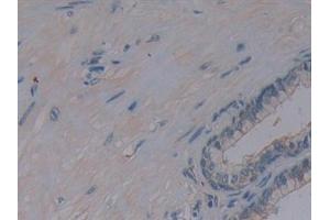 Detection of AMPK Alpha 1 in Human Prostate Tissue using Polyclonal Antibody to Protein Kinase, AMP Activated Alpha 1 (AMPK Alpha 1)