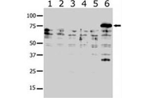 Western blot analysis of PAK6 polyclonal antibody  in lysates from transiently transfected COS-7 cells. (PAK6 anticorps  (AA 131-146))