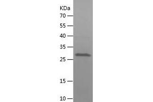 Caspase 3 (CASP3) (AA 29-277) protein (His-IF2DI Tag)