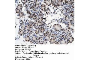 Rabbit Anti-GTF21 Antibody  Paraffin Embedded Tissue: Human Pancreas Cellular Data: Epithelial cells of pancreatic acinus Antibody Concentration: 4. (GTF2I anticorps  (N-Term))