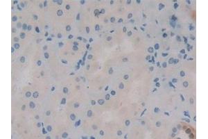 Detection of CR in Human Kidney Tissue using Polyclonal Antibody to Calretinin (CR)