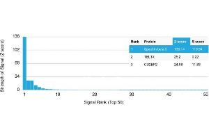 Analysis of Protein Array containing more than 19,000 full-length human proteins using Spectrin beta III Mouse Monoclonal Antibody (SPTBN2/1582).