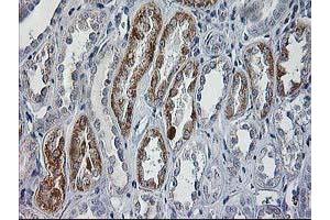 Immunohistochemistry (IHC) image for anti-Cerebral Cavernous Malformation 2 (CCM2) antibody (ABIN1497131) (CCM2 anticorps)