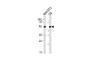 Western blot analysis of lysates from mouse NIH/3T3,rat C6 cell line (from left to right), using Srf Antibody (C-term) (ABIN6242823 and ABIN6577636). (SRF anticorps  (C-Term))
