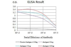 Black line: Control Antigen (100 ng),Purple line: Antigen (10 ng), Blue line: Antigen (50 ng), Red line:Antigen (100 ng)