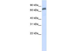 WB Suggested Anti-TRIM45 Antibody Titration:  0. (TRIM45 anticorps  (N-Term))