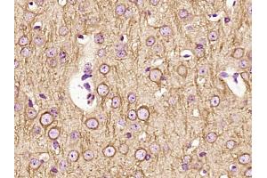 Paraformaldehyde-fixed, paraffin embedded Mouse brain Antigen retrieval by boiling in sodium citrate buffer (pH6.