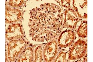IHC image of ABIN7173825 diluted at 1:400 and staining in paraffin-embedded human kidney tissue performed on a Leica BondTM system. (TNFRSF1A anticorps  (AA 263-468))