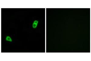 Immunofluorescence analysis of LOVO cells, using GPR34 antibody. (GPR34 anticorps  (Internal Region))