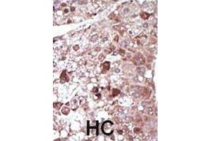 Immunohistochemistry (IHC) image for anti-phosphoenolpyruvate Carboxykinase 1 (Soluble) (PCK1) antibody (ABIN3003679) (PCK1 anticorps)