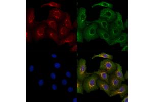 ABIN6263085 and ABIN6279557 staining Hela cells by IF/ICC. (MAL anticorps  (N-Term))