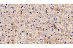 Detection of TSLP in Human Liver Tissue using Monoclonal Antibody to Thymic Stromal Lymphopoietin (TSLP) (Thymic Stromal Lymphopoietin anticorps  (AA 29-159))