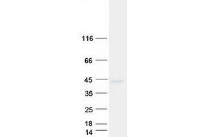 Validation with Western Blot
