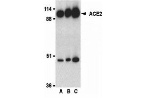 Western Blotting (WB) image for anti-Angiotensin I Converting Enzyme 2 (ACE2) (C-Term) antibody (ABIN1030215) (ACE2 anticorps  (C-Term))