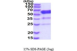 SDS-PAGE (SDS) image for 5'-Nucleotidase, Ecto (CD73) (NT5E) (AA 29-551) (Active) protein (His tag) (ABIN5854793) (CD73 Protein (AA 29-551) (His tag))