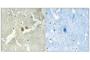 Immunohistochemistry analysis of paraffin-embedded human brain tissue using NSG2 antibody. (NSG2 anticorps)