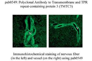 Image no. 1 for anti-Transmembrane and Tetratricopeptide Repeat Containing 3 (TMTC3) (C-Term) antibody (ABIN347751)